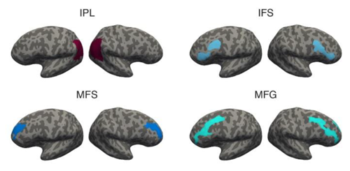 前頭前野と頭頂葉を含む高次脳ネットワーク