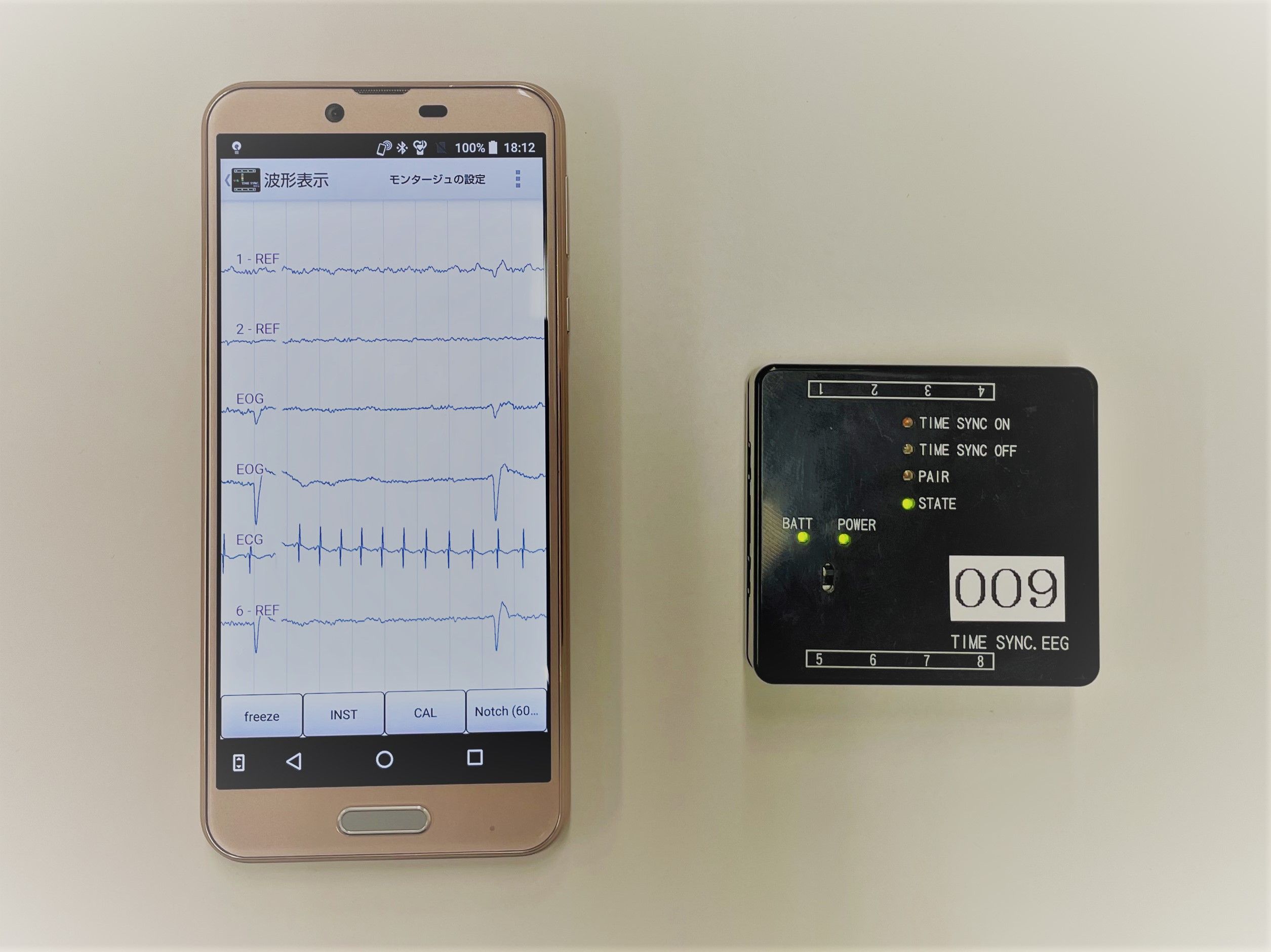 EEG viewed on a smart phone