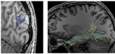 Ensemble Tractography Ensemble Tractography