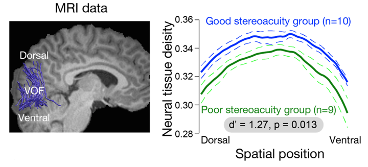 MRI data  Spatial position