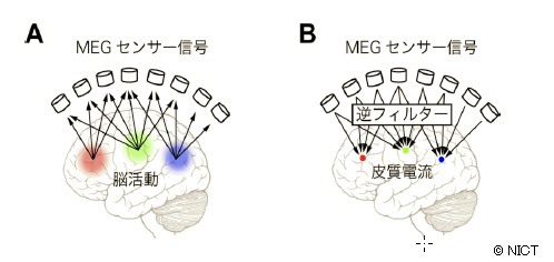 【図3】MEGのセンサー信号