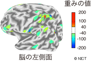 【図6】脳の表面上に色で表した皮質電流に対する重みの値