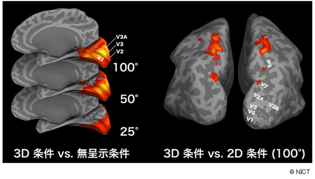 図2： fMRI脳活動計測により捉えた広視野3D映像が脳に与える効果
