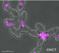NICT のイメージング技術によって観察された染色体とRNA（緑の点がRNA）