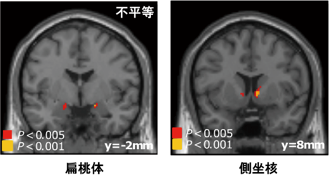 図4 扁桃体と側坐核