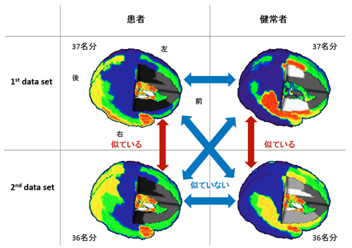 図1　患者群と健常者群の脳部位モジュール解析（色の塗り分け）色の境界（塗り分け方）の類似性に基づいて判断。