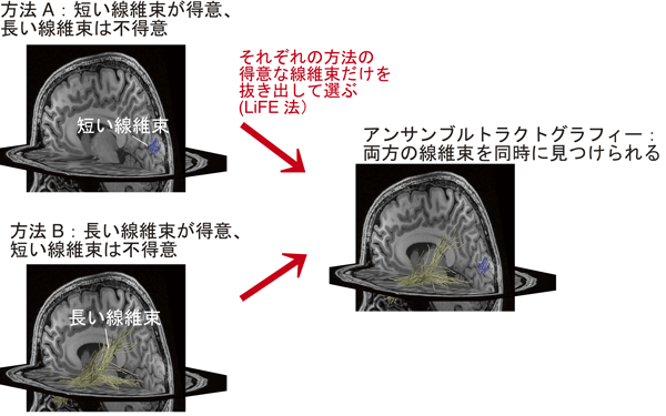 図1 アンサンブルトラクトグラフィー法