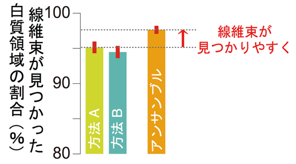 図2 トラクトグラフィーによって見つかった線維束が占める脳の領域の割合 図2 トラクトグラフィーによって見つかった線維束が占める脳の領域の割合
