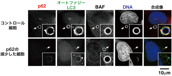 図3: DNAビーズのp62依存的なオートファジー