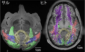 図1 拡散強調MRIによって計測されたサル（左）とヒト（右）の視覚情報伝達に関する白質線維束