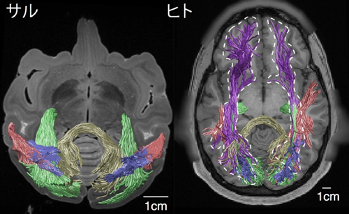 図1 拡散強調MRIによって計測されたサル（左）とヒト（右）の視覚情報伝達に関する白質線維束