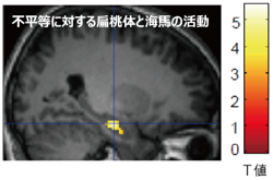 図2 経済的不平等に対する扁桃体と海馬の活動パターン