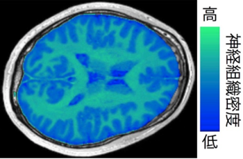 図7: ヒトの脳から計測された定量的MRIデータの例