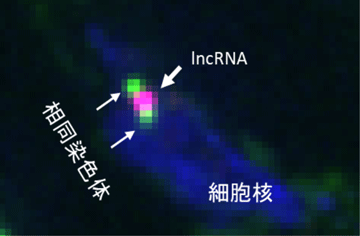 図1  NICTのイメージング技術によって観察された相同染色体（緑色）をつなぐ長鎖非コードRNA（lncRNA）（赤色）液滴の様子