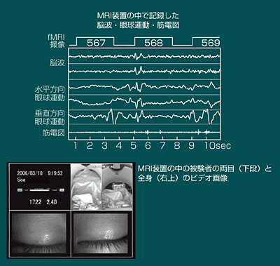 }5FmCY]gEዅ^EIgKC؁i̋ؓj̋ؓd}ijMRIu̒ŖĂ팱҂̃rfI摜ijB