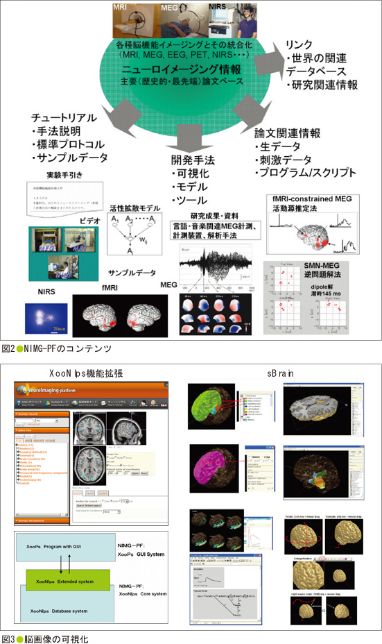 図2 NIMG-PFのコンテンツ ／ 図3 脳画像の可視化