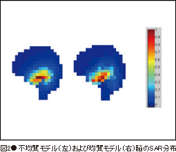 図2●不均質モデル(左)および均質モデル(右)脳のSAR分布