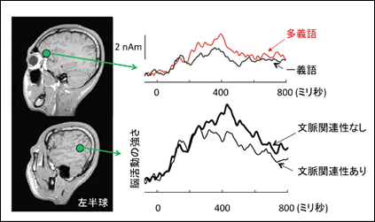図3●意味的な曖昧性と文脈との関連性に関わる脳活動