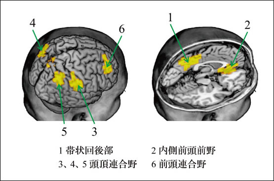 図3　目が醒めている時に比べて、ウトウトしている時に効率が低下した脳の領域